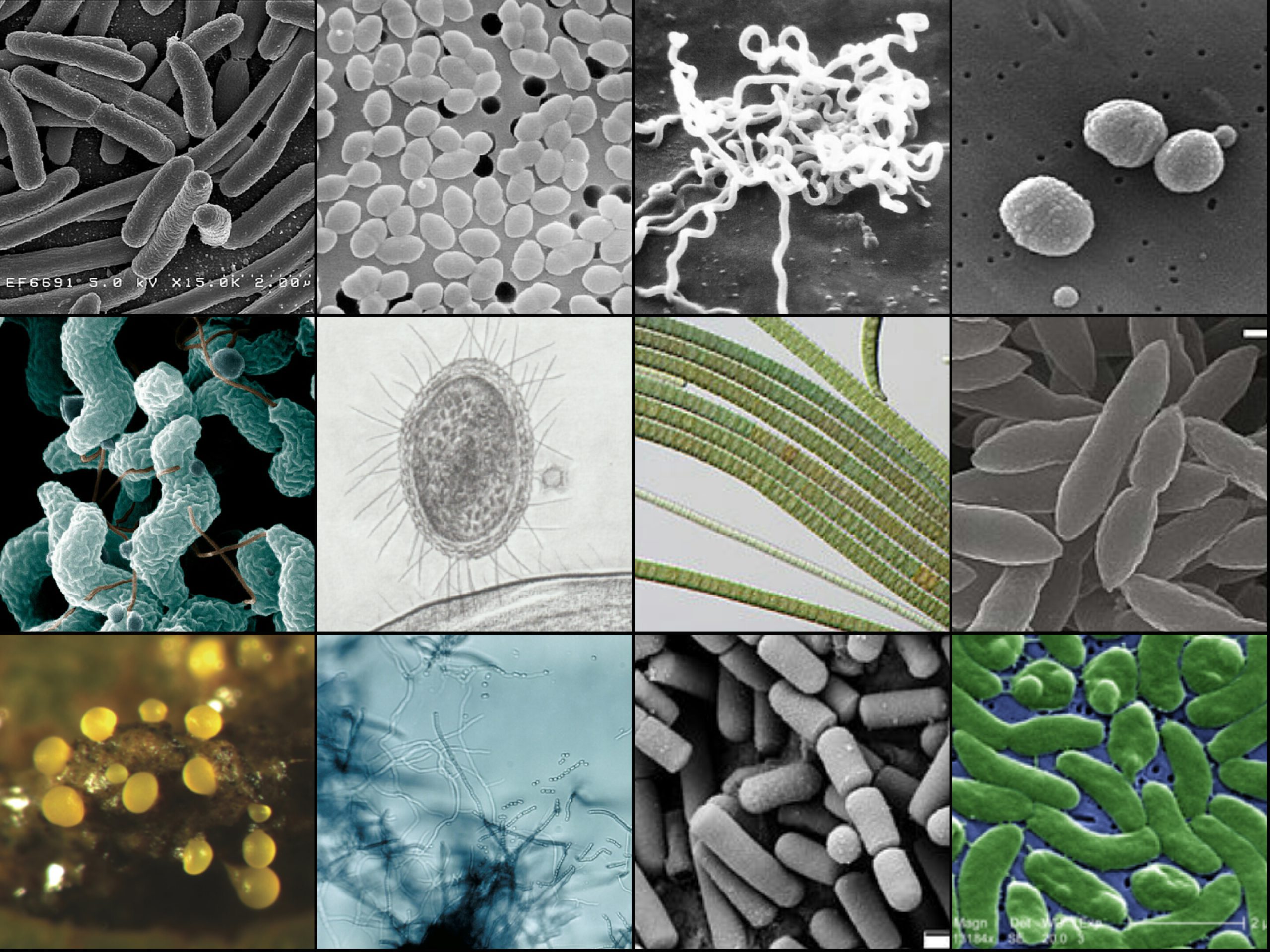 WHO؛ فهرست مهم ترین باکتری های مقاوم به آنتی بیوتیک را بروزرسانی کرد.
