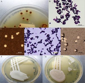 avimehrclinic-Cryptococcus-neoformans-var-A-brown-colony-effect-BCE-on-bird-.jpg
